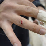 right hand with small cut in finger